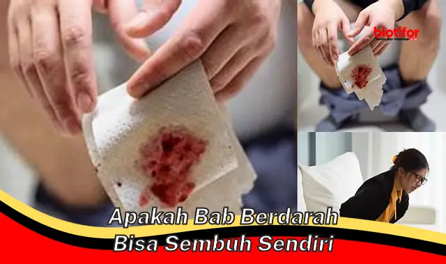 apakah bab berdarah bisa sembuh sendiri apakah bab berdarah bisa sembuh sendiri