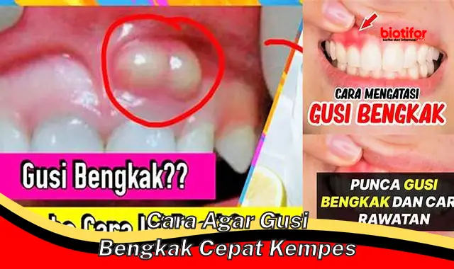 Cara Ampuh Mengempeskan Gusi Bengkak dengan Cepat!