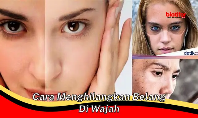 cara menghilangkan belang di wajah cara menghilangkan belang di wajah