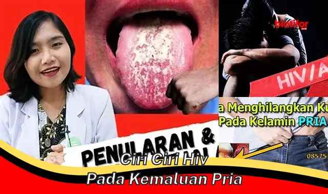 ciri ciri hiv pada kemaluan pria ciri ciri hiv pada kemaluan pria