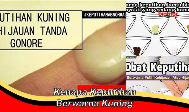 kenapa keputihan berwarna kuning kenapa keputihan berwarna kuning