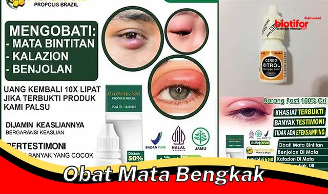 Rahasia Mengatasi Mata Bengkak Efektif dengan Obat Mata Bengkak Terbaik