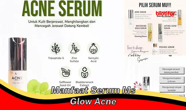 Temukan 5 Manfaat Serum MS Glow Acne yang Jarang Diketahui
