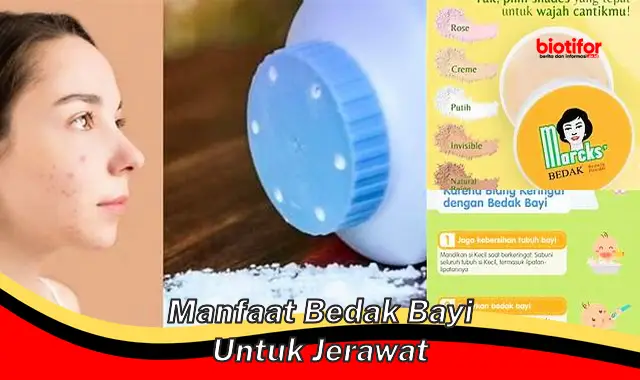 Temukan 5 Manfaat Bedak Bayi Untuk Jerawat yang Jarang Diketahui