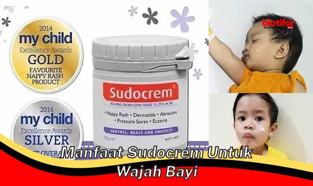 5 Manfaat Sudocrem untuk Wajah Bayi yang Jarang Diketahui