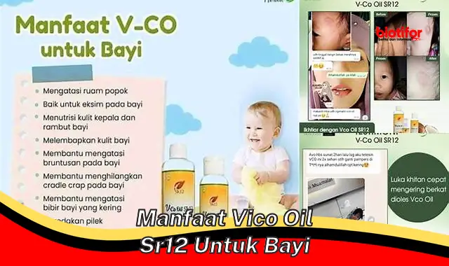 Temukan Manfaat Vico Oil SR12 untuk Bayi yang Jarang Diketahui