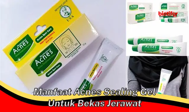 Temukan 5 Manfaat Acnes Sealing Gel untuk Bekas Jerawat yang Perlu Diketahui