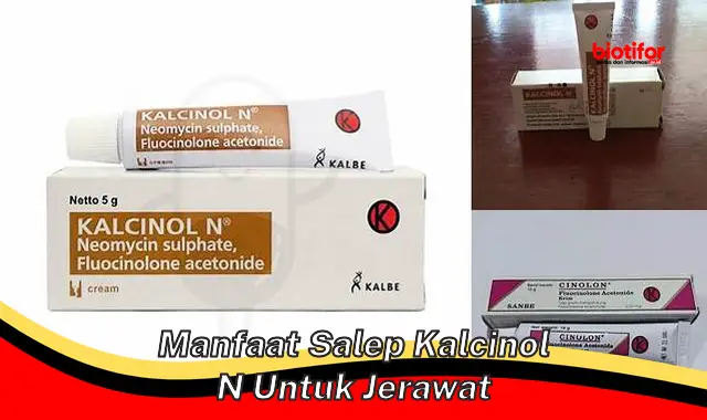 Temukan Manfaat Salep Kalcinol N untuk Jerawat yang Jarang Diketahui!