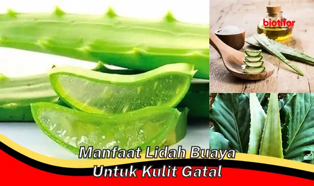 Temukan Manfaat Lidah Buaya untuk Kulit Gatal: Penemuan Langka yang Wajib Diketahui