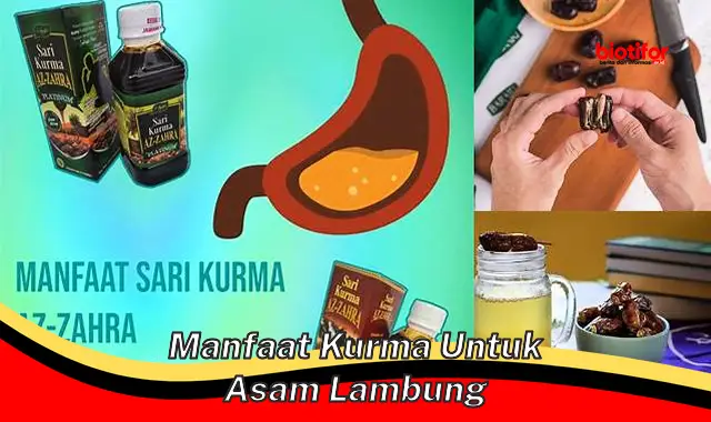 Temukan Khasiat Kurma untuk Asam Lambung yang Jarang Diketahui