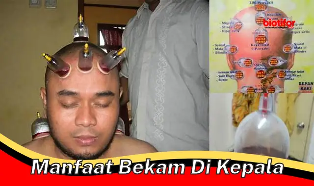 Temukan Berbagai Manfaat Bekam di Kepala yang Jarang Diketahui