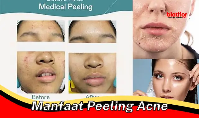 Temukan Manfaat Rahasia Peeling Jerawat yang Jarang Diketahui!