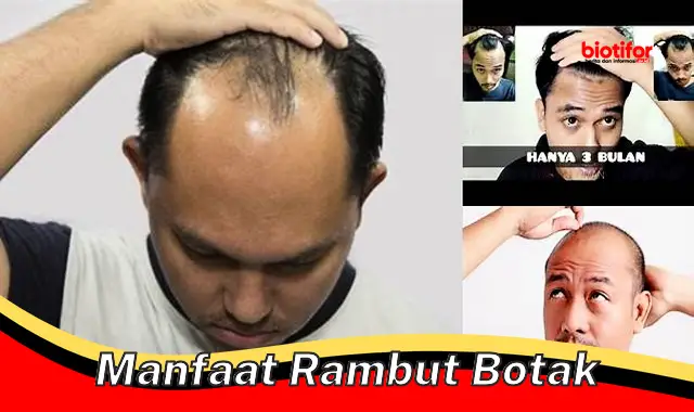 Temukan 5 Manfaat Rambut Botak Yang Jarang Diketahui, Yuk Kepoin!