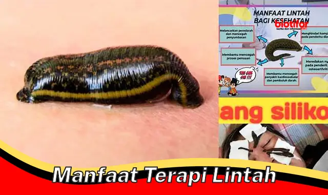 Temukan Manfaat Terapi Lintah yang Jarang Diketahui untuk Kesehatan Anda