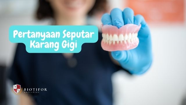 Pertanyaan Seputar Karang Gigi