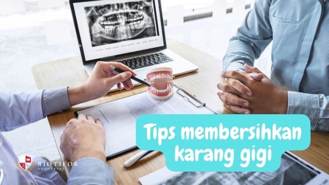 Tips membersihkan karang Gigi