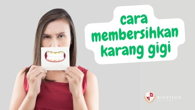 Tips Cara Membersihkan Karang Gigi yang Baik dan Benar