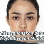 Cara Menghilangkan Belang di Wajah Dengan Mudah