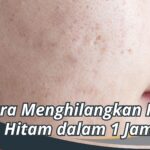 Cara Menghilangkan Flek Hitam dalam 1 Jam