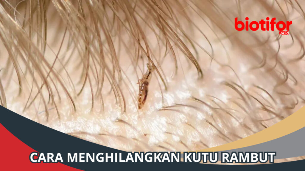 Cara Menghilangkan Kutu Rambut Tips Ampuh dan Alami Biotifor