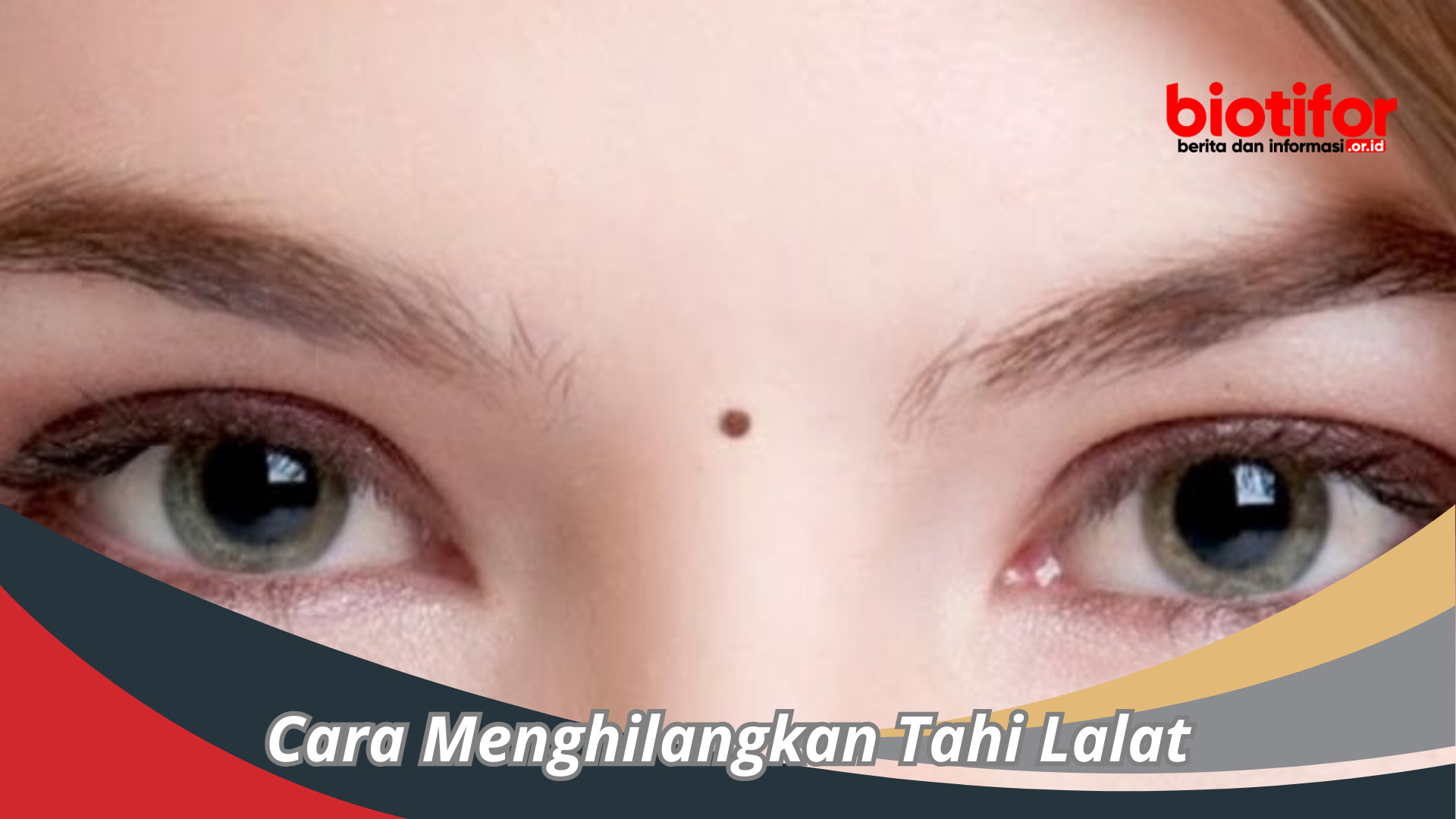 Cara Menghilangkan Tahi Lalat , Dengan Langkah Alami