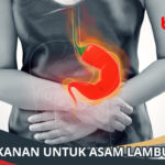 Makanan untuk Asam Lambung