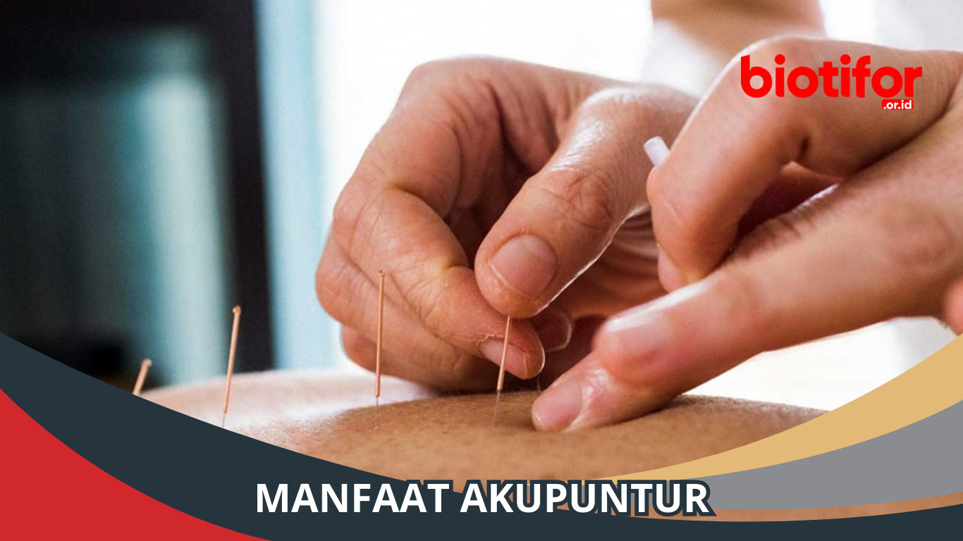 Manfaat Akupuntur untuk Kesehatan, Bikin Damai
