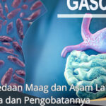 Perbedaan Maag dan Asam Lambung