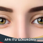 Apa Itu Glaukoma?