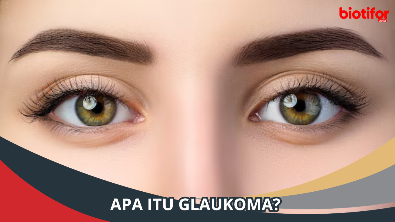 Apa Itu Glaukoma?