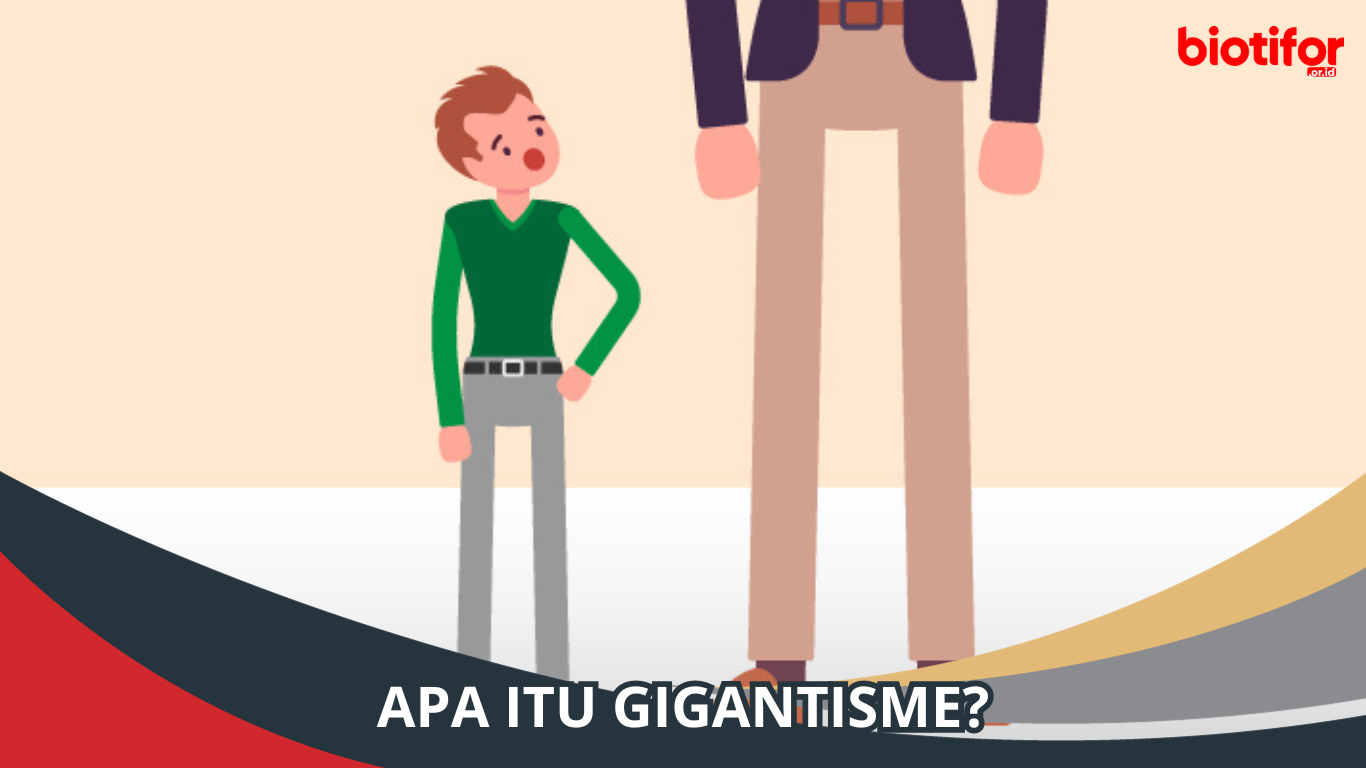 Apa itu Gigantisme?