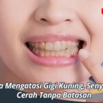 Cara Mengatasi Gigi Kuning, Senyuman Cerah Tanpa Batasan