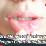 Cara Mengatasi Sariawan dengan Cepat dan Alami