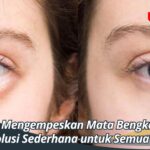 Cara Mengempeskan Mata Bengkak: Solusi Sederhana untuk Semua