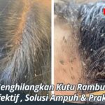 Cara Menghilangkan Kutu Rambut Secara Efektif , Solusi Ampuh & Praktis