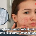 Manfaat Tawas untuk Kulit Gatal: Solusi Alami yang Harus Anda Ketahui