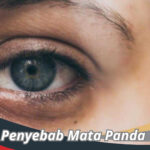 Penyebab Mata Panda