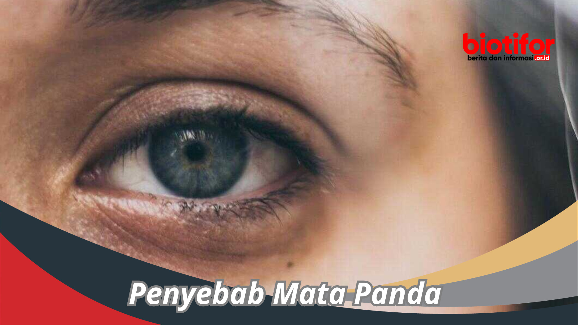 Inilah Penyebab Mata Panda Yang Jarang Diketahui