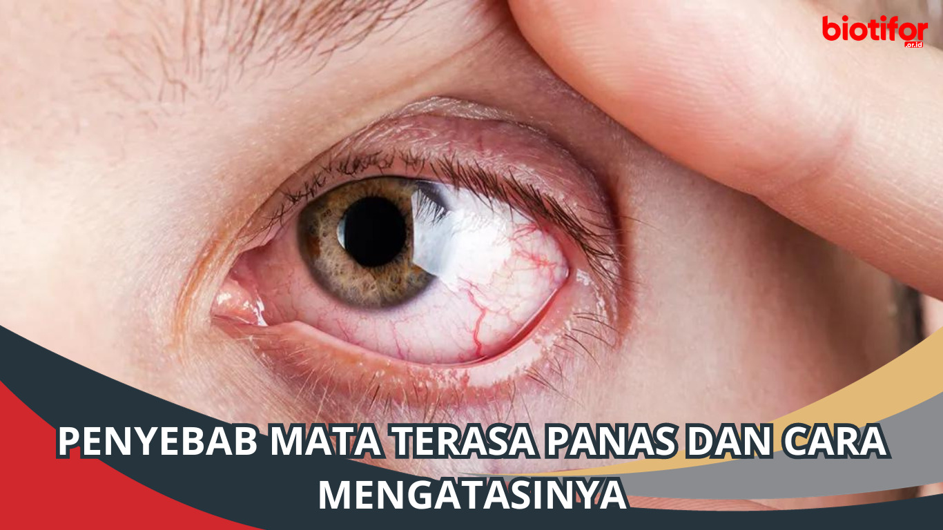 Penyebab Mata Terasa Panas dan Cara Mengatasinya, Jangan Anggap Remeh!