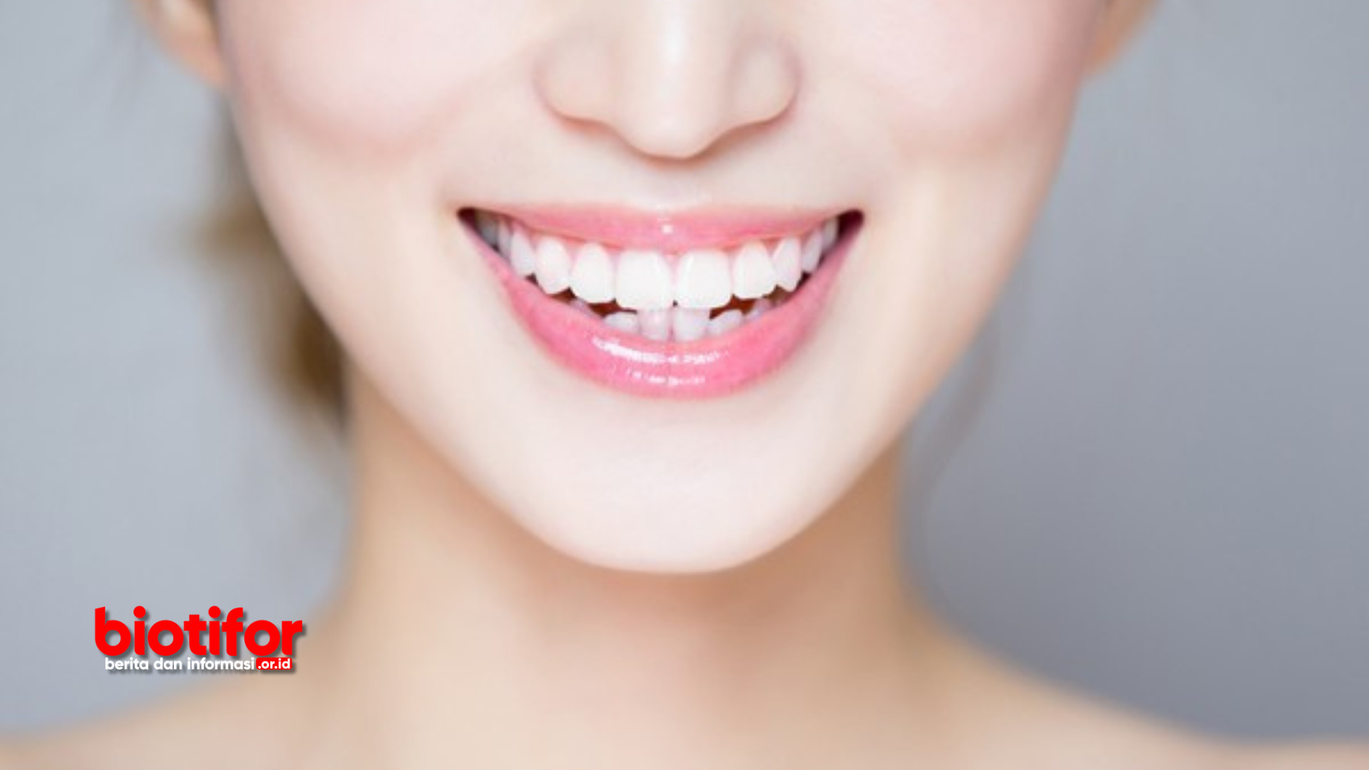 Cara Merapikan Gigi Tanpa Behel