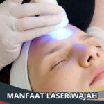 manfaat laser wajah