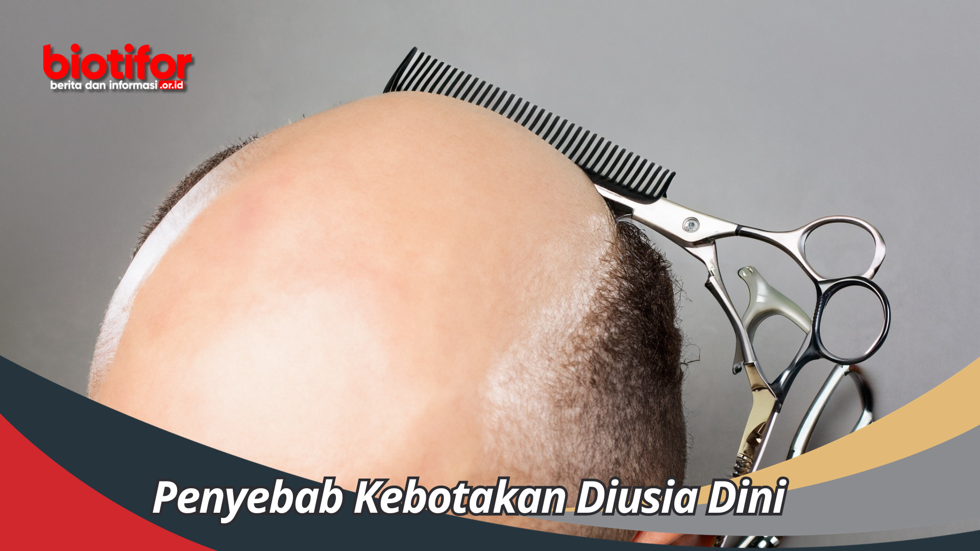 Penyebab Kebotakan Diusia Dini, Mengapa Rambut Anda Rontok?