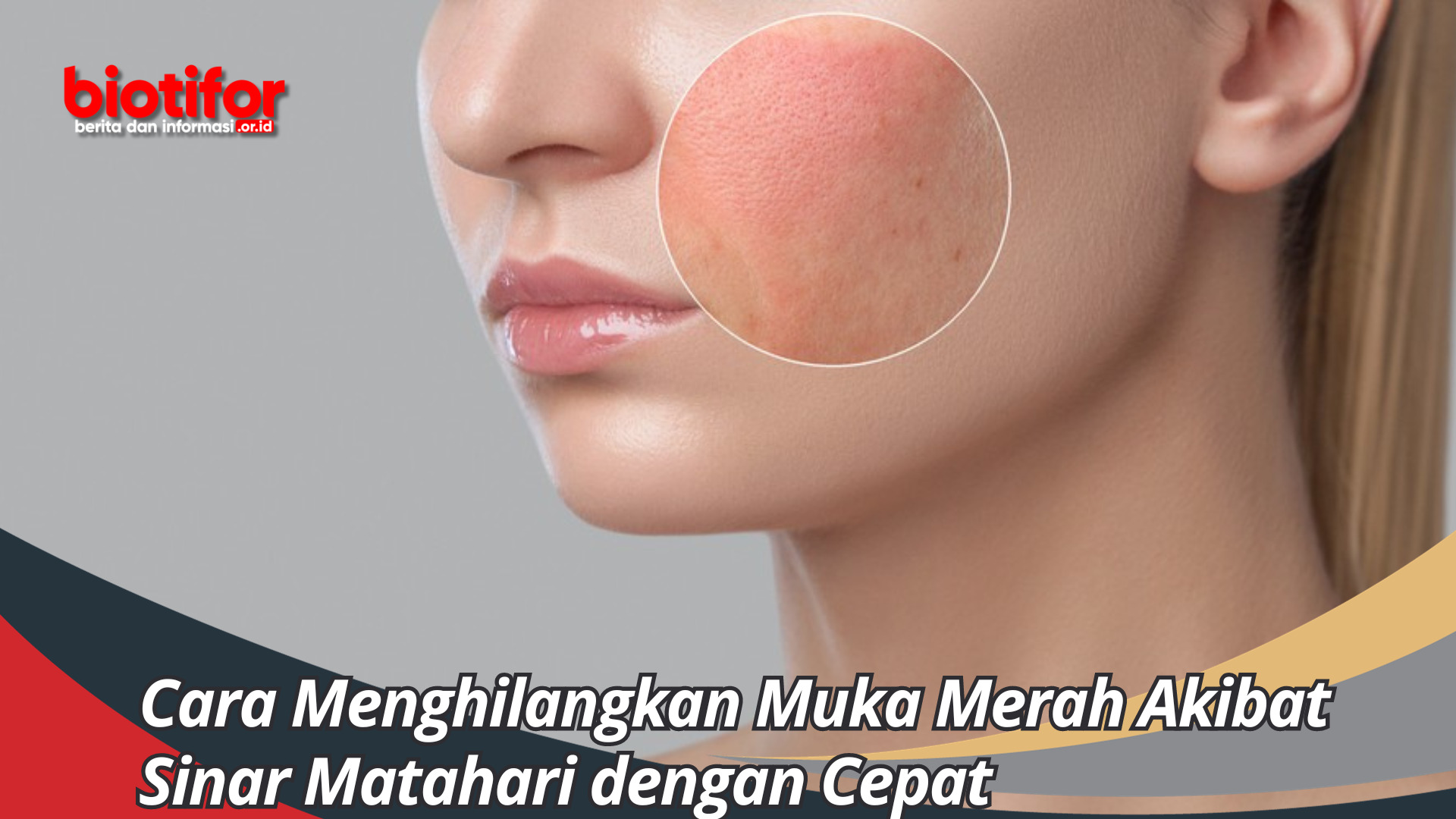 Cara Menghilangkan Muka Merah Akibat Sinar Matahari dengan Cepat