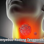 Penyebab Radang Tenggorokan