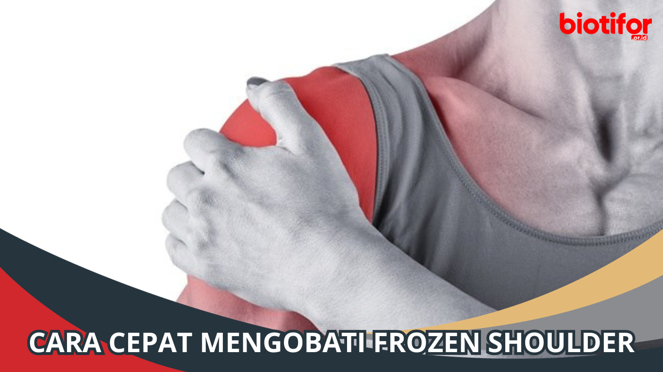 Cara Cepat Mengobati Frozen Shoulder (Bahu Beku)