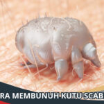 Cara Membunuh Kutu Scabies