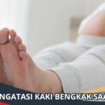 Cara Mengatasi Kaki Bengkak Saat Hamil