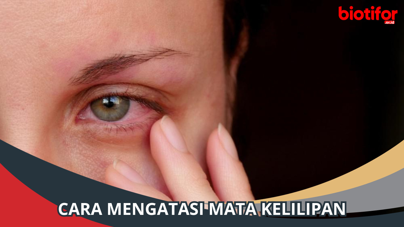 Cara Mengatasi Mata Kelilipan: Tips Praktis untuk Kesehatan Mata
