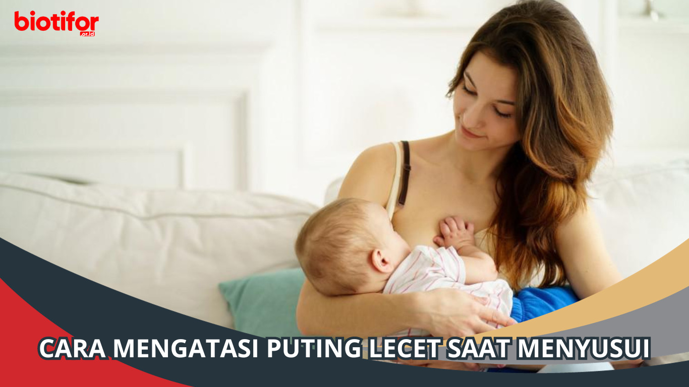 Cara Mengatasi Puting Lecet Saat Menyusui