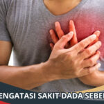 Cara Mengatasi Sakit Dada Sebelah Kiri